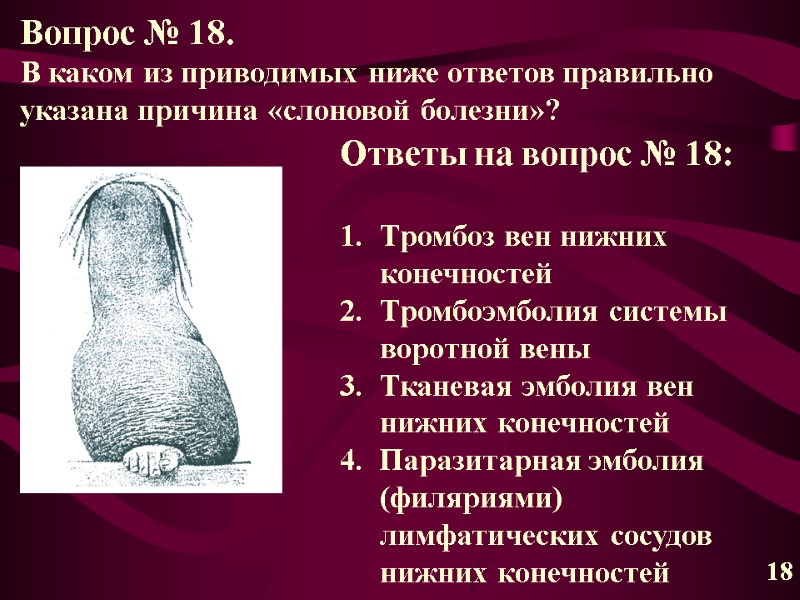 Вопрос № 18. В каком из приводимых ниже ответов правильно указана причина «слоновой болезни»?